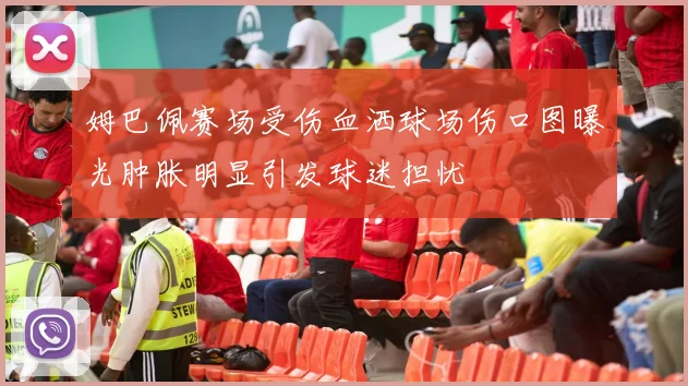 姆巴佩赛场受伤血洒球场伤口图曝光肿胀明显引发球迷担忧